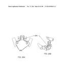 PATIENT-MATCHED APPARATUS AND METHODS FOR PERFORMING SURGICAL PROCEDURES diagram and image