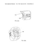 PATIENT-MATCHED APPARATUS AND METHODS FOR PERFORMING SURGICAL PROCEDURES diagram and image