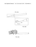 PATIENT-MATCHED APPARATUS AND METHODS FOR PERFORMING SURGICAL PROCEDURES diagram and image