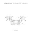 PATIENT-MATCHED APPARATUS AND METHODS FOR PERFORMING SURGICAL PROCEDURES diagram and image