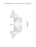 PATIENT-MATCHED APPARATUS AND METHODS FOR PERFORMING SURGICAL PROCEDURES diagram and image