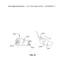 PATIENT-MATCHED APPARATUS AND METHODS FOR PERFORMING SURGICAL PROCEDURES diagram and image