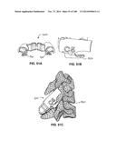 PATIENT-MATCHED APPARATUS AND METHODS FOR PERFORMING SURGICAL PROCEDURES diagram and image