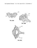 PATIENT-MATCHED APPARATUS AND METHODS FOR PERFORMING SURGICAL PROCEDURES diagram and image