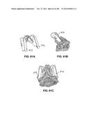 PATIENT-MATCHED APPARATUS AND METHODS FOR PERFORMING SURGICAL PROCEDURES diagram and image