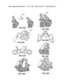 PATIENT-MATCHED APPARATUS AND METHODS FOR PERFORMING SURGICAL PROCEDURES diagram and image