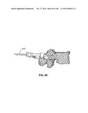 PATIENT-MATCHED APPARATUS AND METHODS FOR PERFORMING SURGICAL PROCEDURES diagram and image