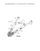 PATIENT-MATCHED APPARATUS AND METHODS FOR PERFORMING SURGICAL PROCEDURES diagram and image