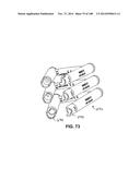 PATIENT-MATCHED APPARATUS AND METHODS FOR PERFORMING SURGICAL PROCEDURES diagram and image