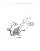 PATIENT-MATCHED APPARATUS AND METHODS FOR PERFORMING SURGICAL PROCEDURES diagram and image