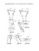 PATIENT-MATCHED APPARATUS AND METHODS FOR PERFORMING SURGICAL PROCEDURES diagram and image