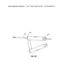 PATIENT-MATCHED APPARATUS AND METHODS FOR PERFORMING SURGICAL PROCEDURES diagram and image