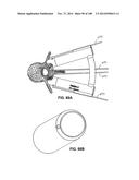 PATIENT-MATCHED APPARATUS AND METHODS FOR PERFORMING SURGICAL PROCEDURES diagram and image