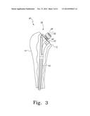 Osteotomy Protective Cover diagram and image