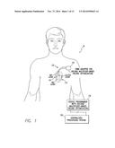 SYSTEM AND METHOD FOR CONTROLLING ELECTRICAL STIMULATION BASED ON LOWEST     OPERABLE VOLTAGE MULTIPLIER FOR USE WITH IMPLANTABLE MEDICAL DEVICE diagram and image