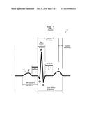 SYSTEM AND METHOD FOR STIMULATING THE HEART VIA THE VAGUS NERVE diagram and image