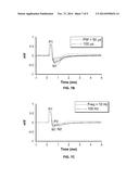 DEVICES, SYSTEMS AND METHODS FOR DEEP BRAIN STIMULATION PARAMETERS diagram and image