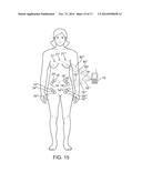 WIRELESS CARDIORESONANCE STIMULATION diagram and image