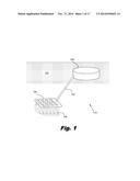 MODULAR BIOMEDICAL IMPLANTS diagram and image