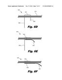 MODULAR BIOMEDICAL IMPLANTS diagram and image