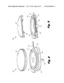 MODULAR BIOMEDICAL IMPLANTS diagram and image