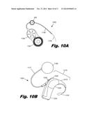 MODULAR BIOMEDICAL IMPLANTS diagram and image