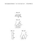 COLLAPSIBLE AND RE-EXPANDABLE PROSTHETIC HEART VALVE CUFF DESIGNS AND     COMPLEMENTARY TECHNOLOGICAL APPLICATIONS diagram and image