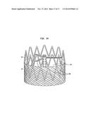 COLLAPSIBLE AND RE-EXPANDABLE PROSTHETIC HEART VALVE CUFF DESIGNS AND     COMPLEMENTARY TECHNOLOGICAL APPLICATIONS diagram and image