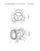 EXPANDABLE PROSTHETIC VALVE HAVING ANCHORING APPENDAGES diagram and image