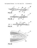 ELEMENTS FOR VERSATILITY OF A PROSTHETIC ANCHOR diagram and image