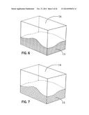 ELEMENTS FOR VERSATILITY OF A PROSTHETIC ANCHOR diagram and image