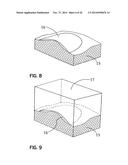 ELEMENTS FOR VERSATILITY OF A PROSTHETIC ANCHOR diagram and image