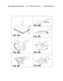 ELEMENTS FOR VERSATILITY OF A PROSTHETIC ANCHOR diagram and image