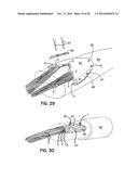 ELEMENTS FOR VERSATILITY OF A PROSTHETIC ANCHOR diagram and image