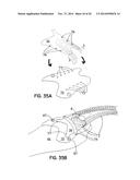 ELEMENTS FOR VERSATILITY OF A PROSTHETIC ANCHOR diagram and image