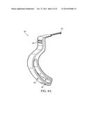 METHOD FOR TREATING JOINT PAIN AND ASSOCIATED INSTRUMENTS diagram and image