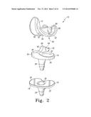 ORTHOPAEDIC FEMORAL COMPONENT HAVING CONTROLLED CONDYLAR CURVATURE diagram and image