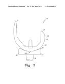 ORTHOPAEDIC FEMORAL COMPONENT HAVING CONTROLLED CONDYLAR CURVATURE diagram and image