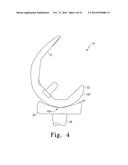 ORTHOPAEDIC FEMORAL COMPONENT HAVING CONTROLLED CONDYLAR CURVATURE diagram and image