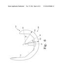 ORTHOPAEDIC FEMORAL COMPONENT HAVING CONTROLLED CONDYLAR CURVATURE diagram and image