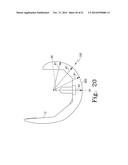 ORTHOPAEDIC FEMORAL COMPONENT HAVING CONTROLLED CONDYLAR CURVATURE diagram and image