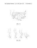 SYSTEMS AND METHODS FOR PROVIDING A FEMORAL COMPONENT diagram and image