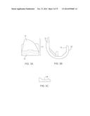 SYSTEMS AND METHODS FOR PROVIDING A FEMORAL COMPONENT diagram and image