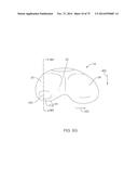 SYSTEMS AND METHODS FOR PROVIDING A FEMORAL COMPONENT diagram and image