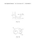 SYSTEMS AND METHODS FOR PROVIDING A FEMORAL COMPONENT diagram and image