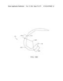 SYSTEMS AND METHODS FOR PROVIDING A FEMORAL COMPONENT diagram and image