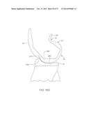 SYSTEMS AND METHODS FOR PROVIDING A FEMORAL COMPONENT diagram and image