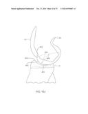 SYSTEMS AND METHODS FOR PROVIDING A FEMORAL COMPONENT diagram and image