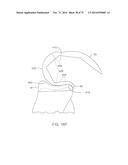 SYSTEMS AND METHODS FOR PROVIDING A FEMORAL COMPONENT diagram and image