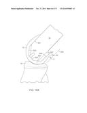 SYSTEMS AND METHODS FOR PROVIDING A FEMORAL COMPONENT diagram and image